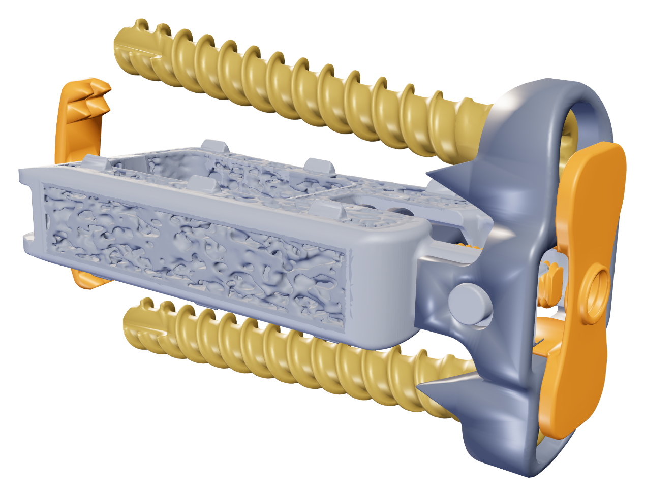 Interwedge® Standalone Lateral implant with bone screws, pivoting lateral plate, cover plate, and deployable staple