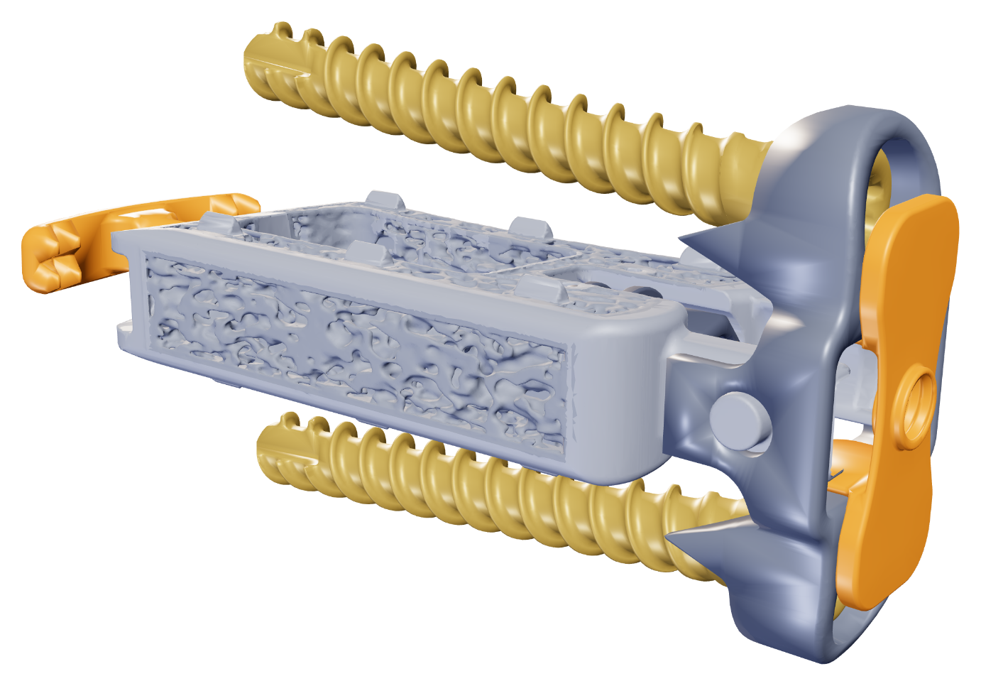 Interwedge® deployable staple extended from the implant