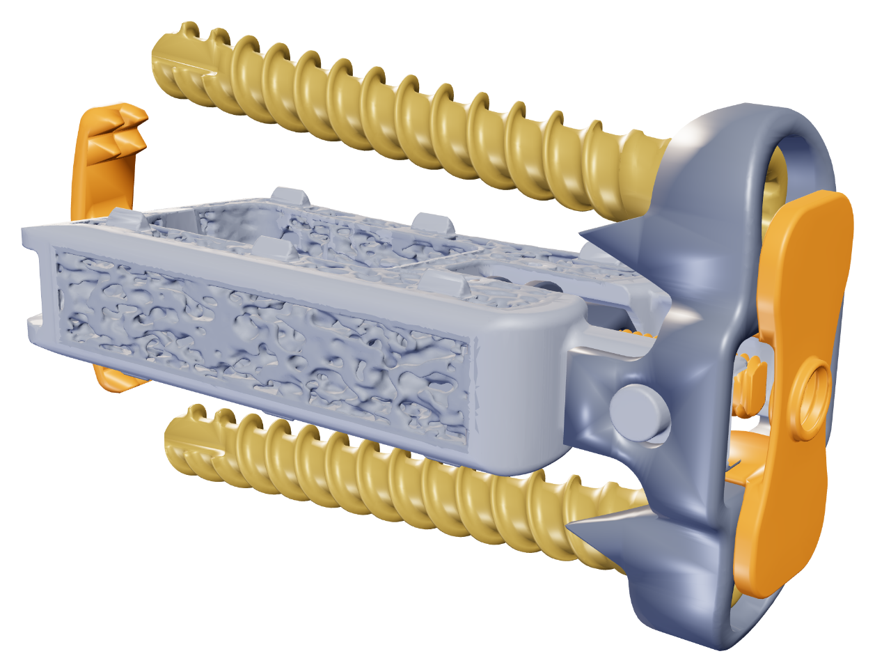 Interwedge® deployable staple retracted toward the implant