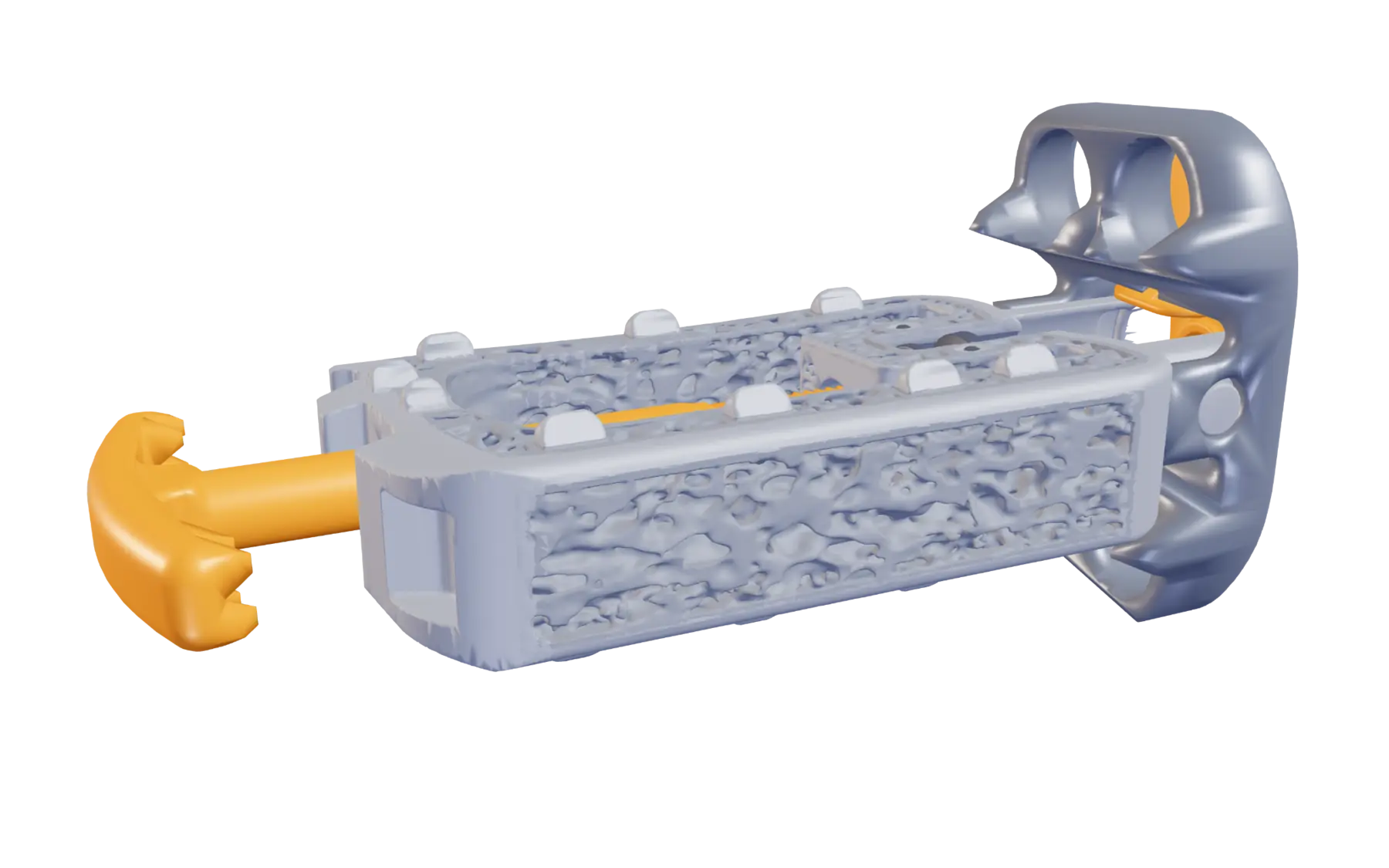 Vertiwedge staple extended from the implant
