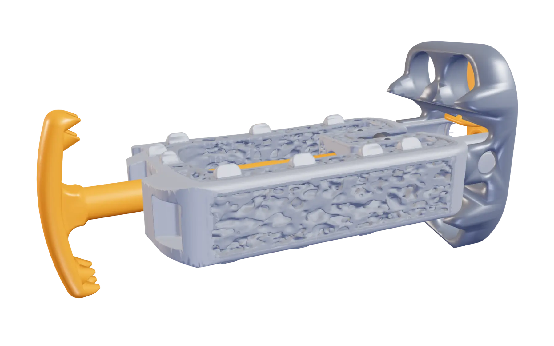 Vertiwedge staple rotated into fixation orientation